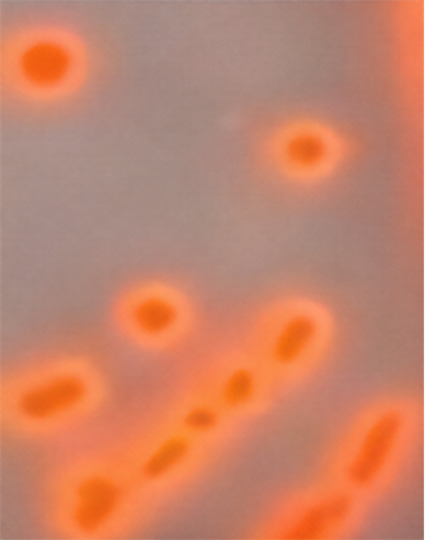 Anaerobic bacteria-β-D-galactosidase substrate - red colony color development effect